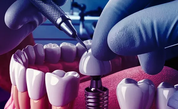 Oral Surgery