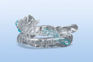 Mandibular Advancement Device (MAD) for Snoring & Sleep Apnea